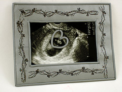 Polymer Clay Ultrasound Frame